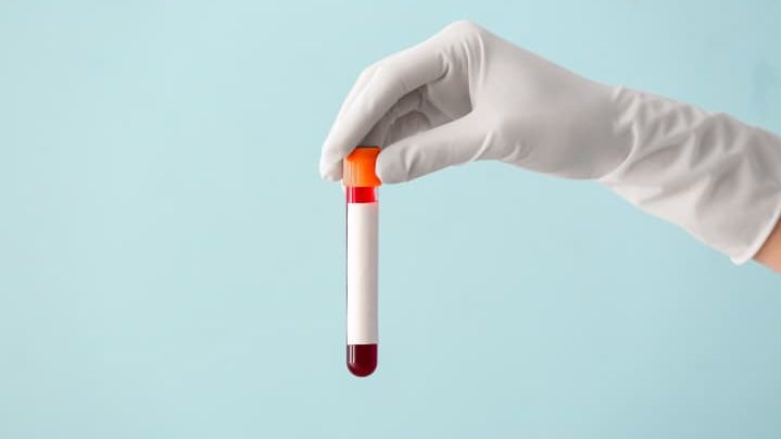 成分採血のイメージ